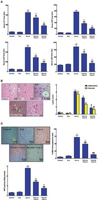Pristimerin as a Novel Hepatoprotective Agent Against Experimental Autoimmune Hepatitis